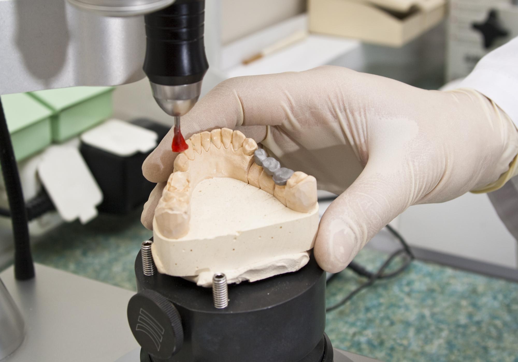 Blog prothesiste dentaire 04 picture