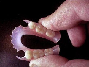 prothese dentaire partielle amovible en resine 2